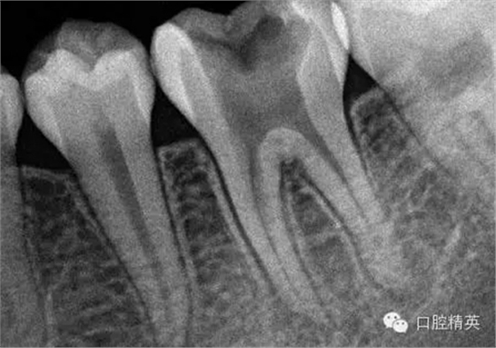 9.webp.jpg 9.webp.jpg