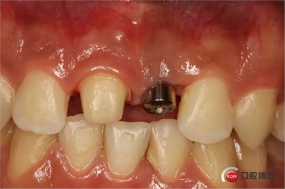 2.webp.jpg 2.webp.jpg