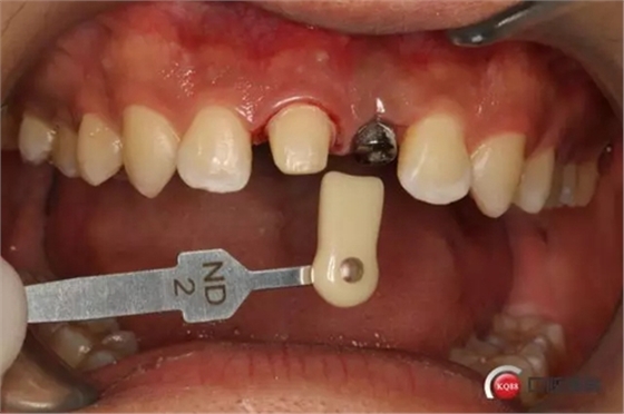 4.webp.jpg 4.webp.jpg