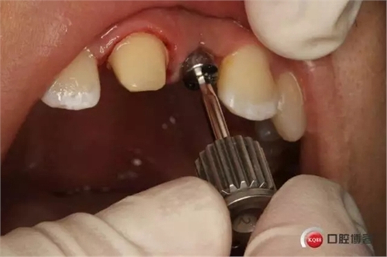 5.webp.jpg 5.webp.jpg