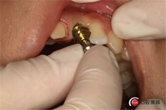 6.webp.jpg 6.webp.jpg