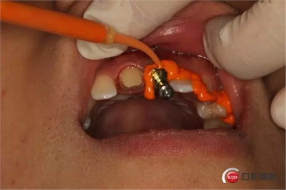 9.webp.jpg 9.webp.jpg