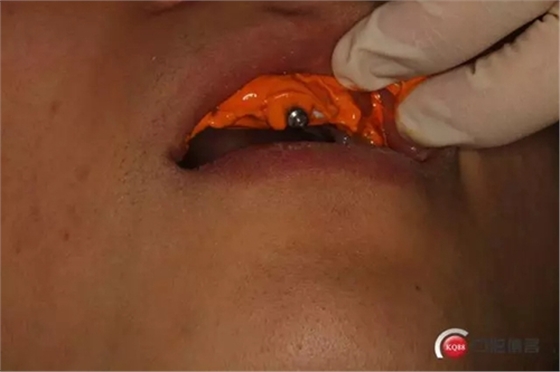 11.webp.jpg 11.webp.jpg