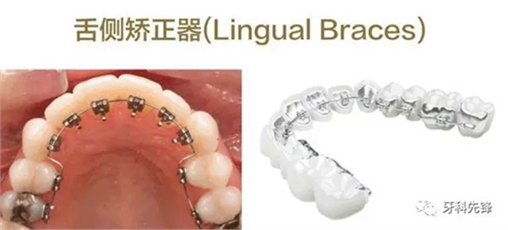 9.webp.jpg 9.webp.jpg