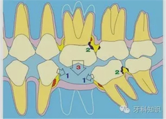 1.webp.jpg 1.webp.jpg