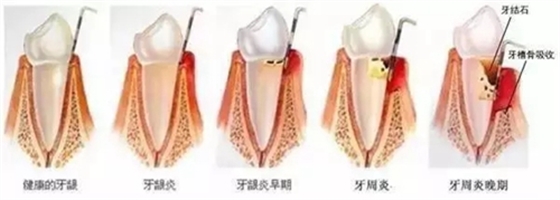 4.webp.jpg 4.webp.jpg