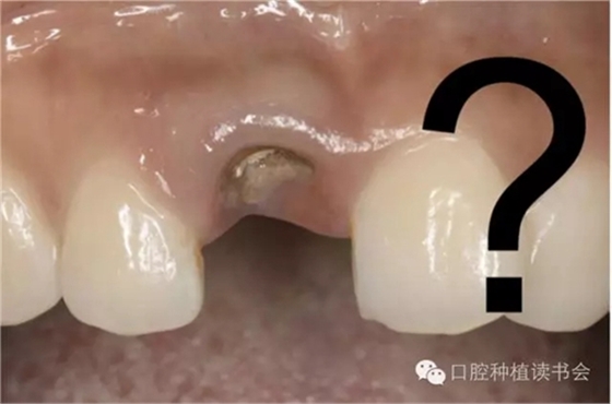 1.webp.jpg 1.webp.jpg