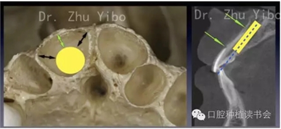 3.webp.jpg 3.webp.jpg