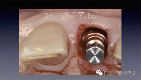 5.webp.jpg 5.webp.jpg