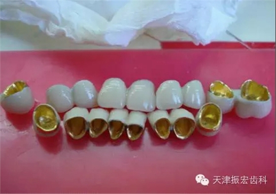 4.webp.jpg 4.webp.jpg