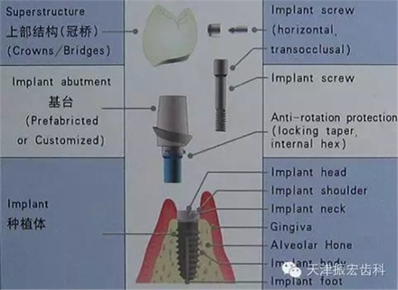 8.webp.jpg 8.webp.jpg