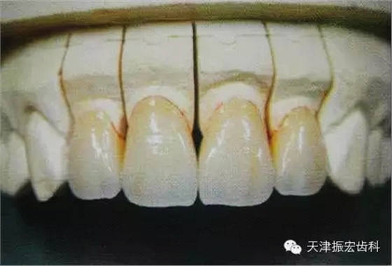 640.webp.jpg 640.webp.jpg