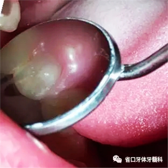 1.webp.jpg 1.webp.jpg