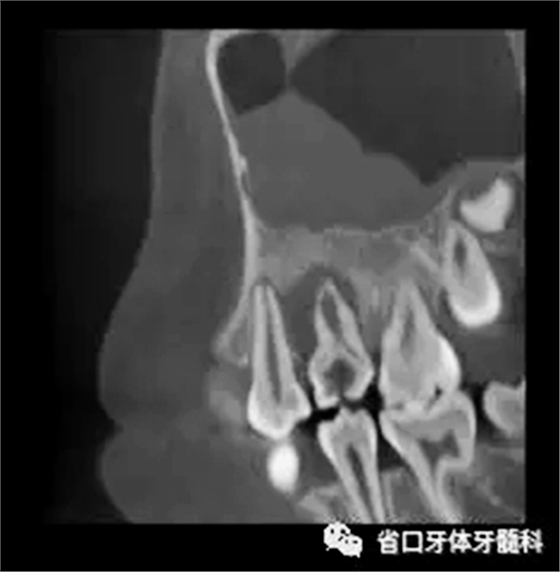 4.webp.jpg 4.webp.jpg