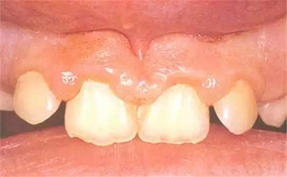 3.webp.jpg 3.webp.jpg