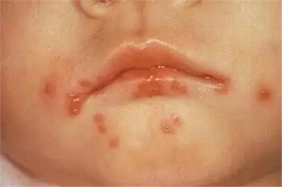 5.webp.jpg 5.webp.jpg