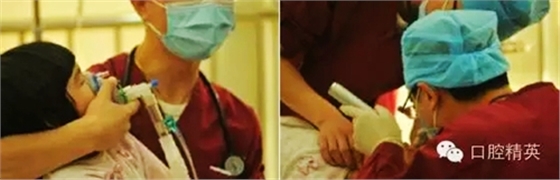 全麻下兒科治療+兒牙樹脂充填 全麻下兒科治療+兒牙樹脂充填