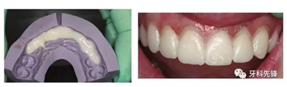 5.webp.jpg 5.webp.jpg