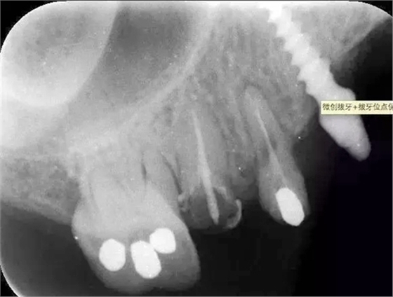 1.webp.jpg 1.webp.jpg