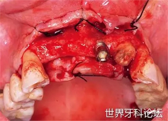 13.webp.jpg 13.webp.jpg