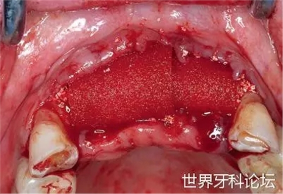 17.webp.jpg 17.webp.jpg