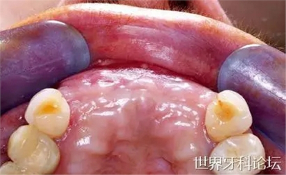 20.webp.jpg 20.webp.jpg