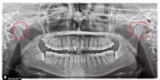 1.webp.jpg 1.webp.jpg