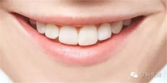 3.webp.jpg 3.webp.jpg