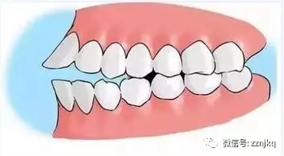 4.webp.jpg 4.webp.jpg