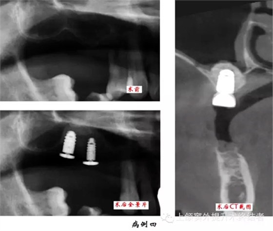 5.webp.jpg 5.webp.jpg