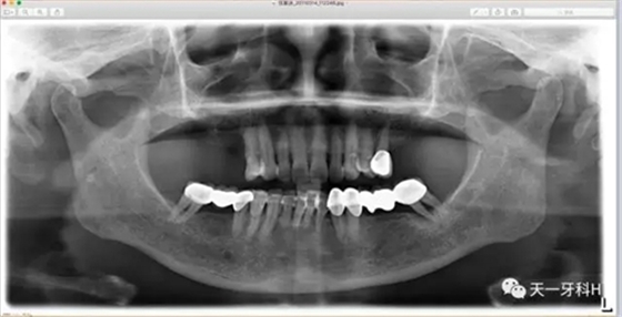 5.webp.jpg 5.webp.jpg