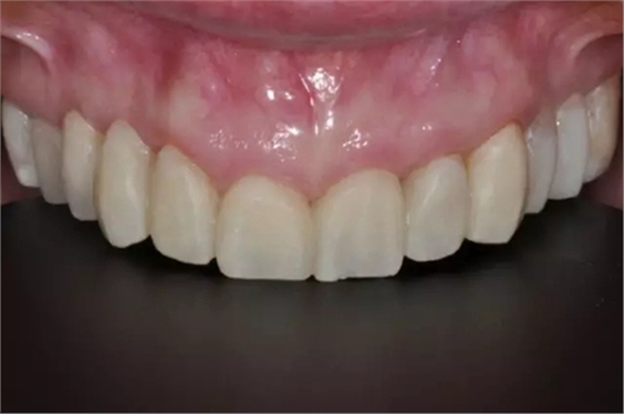 8.webp.jpg 8.webp.jpg