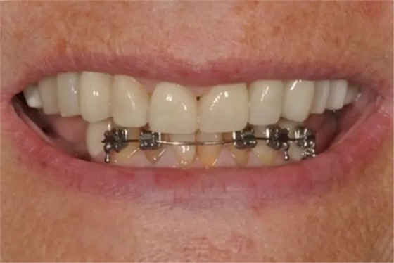 9.webp.jpg 9.webp.jpg