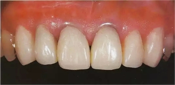 16.webp.jpg 16.webp.jpg