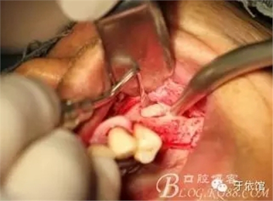 2.webp.jpg 2.webp.jpg