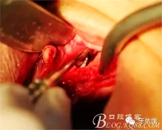 3.webp.jpg 3.webp.jpg