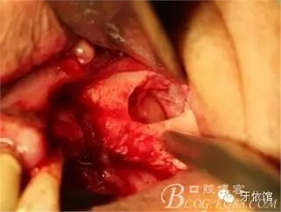 4.webp.jpg 4.webp.jpg