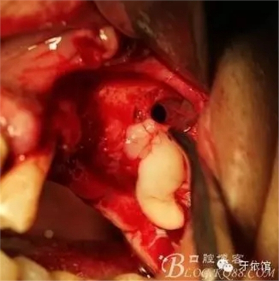 5.webp.jpg 5.webp.jpg