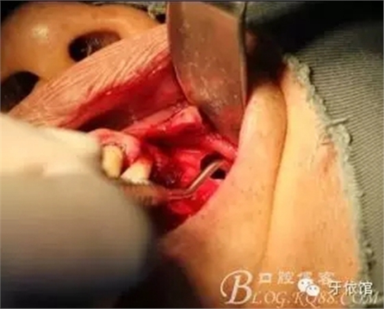 6.webp.jpg 6.webp.jpg