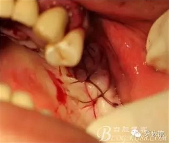 15.webp.jpg 15.webp.jpg