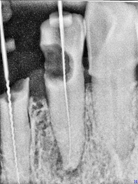 5.webp.jpg 5.webp.jpg