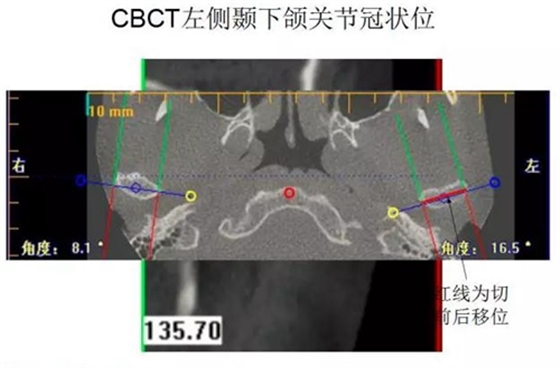 	口腔修復治療中，常見臨床接診流程