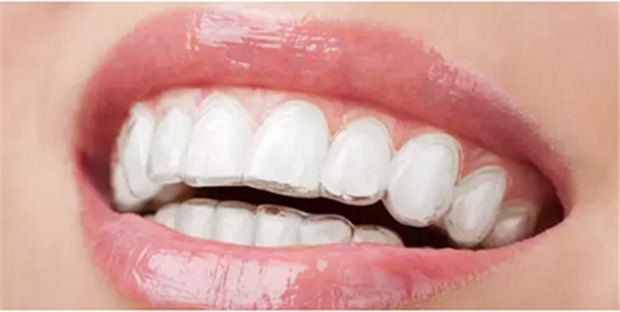 正畸流程(拔牙) 正畸流程(拔牙)