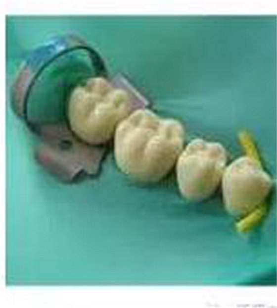 根管治療圖譜 根管治療圖譜