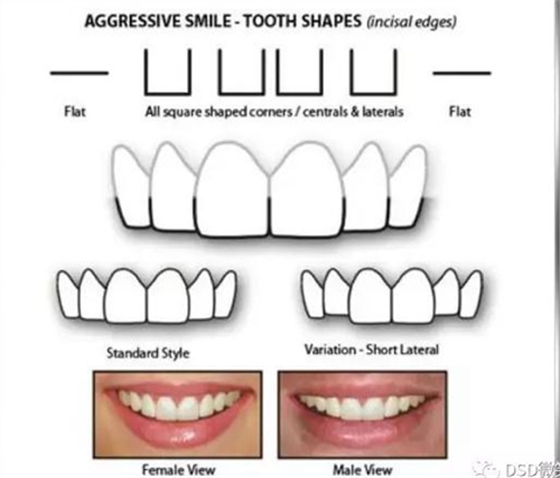美學(xué)知識(shí)分享--切緣形態(tài)分類 美學(xué)知識(shí)分享--切緣形態(tài)分類