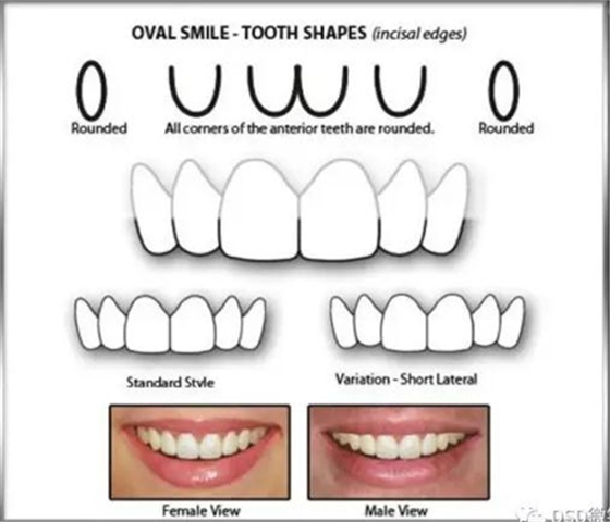 美學(xué)知識(shí)分享--切緣形態(tài)分類 美學(xué)知識(shí)分享--切緣形態(tài)分類