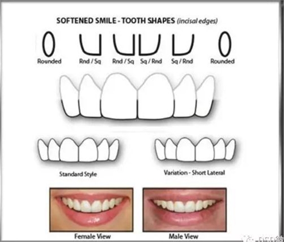 美學(xué)知識(shí)分享--切緣形態(tài)分類 美學(xué)知識(shí)分享--切緣形態(tài)分類