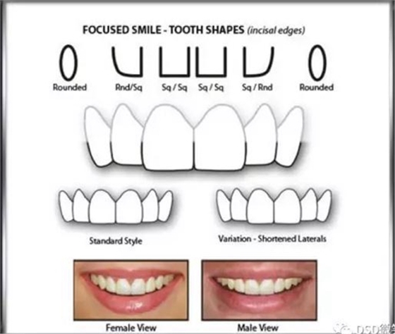 美學(xué)知識(shí)分享--切緣形態(tài)分類 美學(xué)知識(shí)分享--切緣形態(tài)分類
