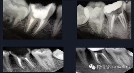 新熱熔充填系統(tǒng)C-Fill 新熱熔充填系統(tǒng)C-Fill
