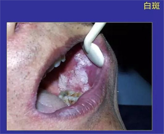 正?？谇火つぜ俺Ｒ姴p圖